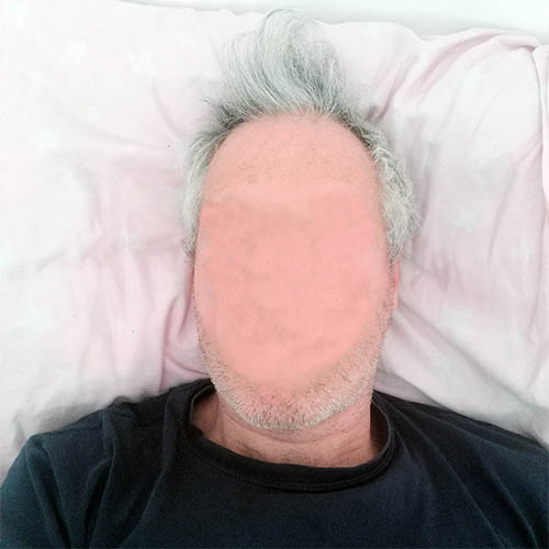 I woke up without a face